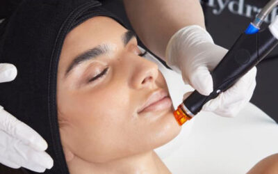 A Touch of Class: Your Certified Official HydraFacial Provider in Cheadle, Cheshire